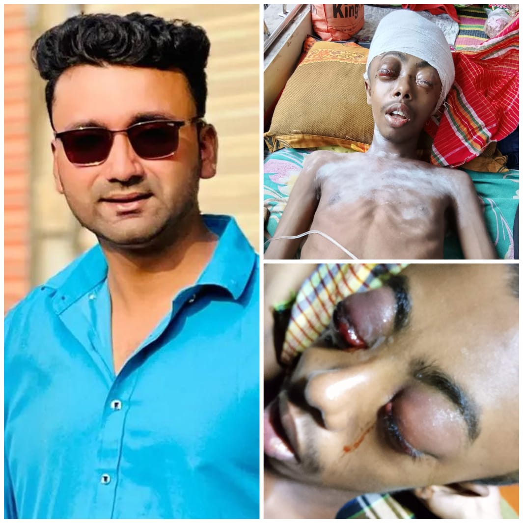 সাভারে কিশোরকে তুলে নিয়ে নির্যাতনের অভিযোগ ছাত্রদল নেতার বিরুদ্ধে, চোখ হারানোর শঙ্কা